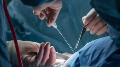 فريق طبي ينجح في إعادة بصر شاب بمستشفيات جامعة بني سويف