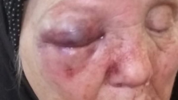 الابن العاق.. كشف ملابسات الاعتداء على أم مسنة بالغربية وملاحقة المتهم الهارب