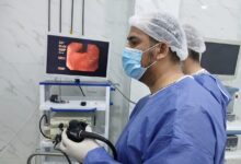   صحة الشرقية: وحدة مناظير الجهاز الهضمي بفاقوس المركزي تُنفذ عشرمناظير   