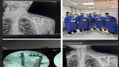 نجاح جراحة نادرة بمستشفى التأمين الصحي بالفيوم تنقذ شابًا من كسر معقد.