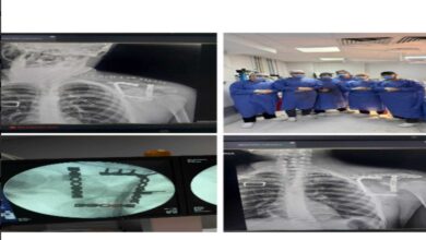 نجاح جراحة نادرة بمستشفى التأمين الصحي بالفيوم تنقذ شابًا من كسر معقد.