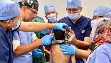 تكلفة الواحدة 480جنيها..” الكرنك الدولى بالأقصر” تجرى 3عمليات لمرضى الشلل الرعاش والديستونيا