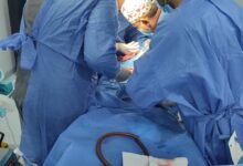 صحة البحيرة .. اجراء تدخل جراحي متقدم لطفل عمره 5 أيام بمستشفى الأطفال التخصصي بأبوحمص