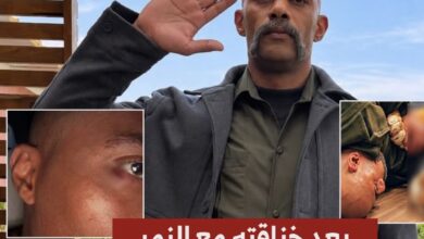 للمرة الثانية.. إصابة محمد رمضان في عينه أثناء تصوير «عشماوي» بعد خناقته مع النمر! ماذا حدث